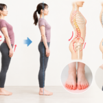 反り腰を改善するには？筋肉だけでなく体の使い方も重要